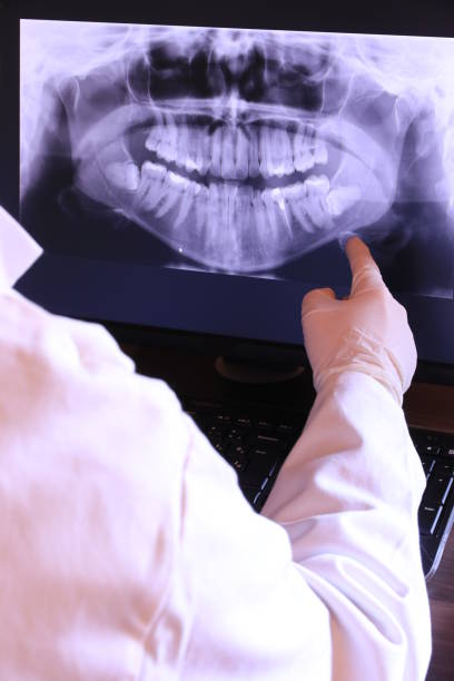 Best Emergency Tooth Extraction in Caldwell, OH